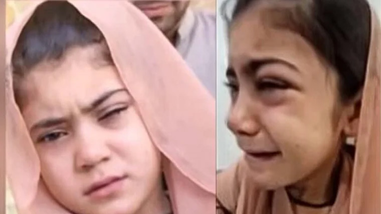 چمن :مدرسے کے استاد کا مبینہ تشدد ، 7سالہ بچی کی آنکھ ضائع
