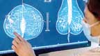 اے آئی کو ریڈیولوجسٹ کے بغیر میموگرامز کا جائزہ لینے کی اجازت