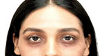 آنکھوں کے نیچے سیاہ حلقے کم کرنے کے آسان گھریلو طریقے