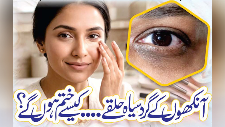 آنکھوں کے گرد سیاہ حلقے…  کیسے ختم ہوں گے؟