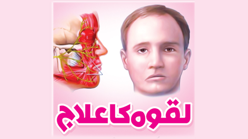 لقوہ کا علاج