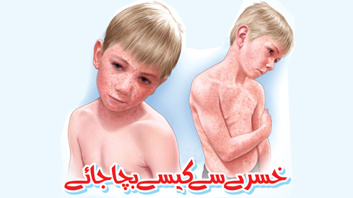 خسرے سے کیسے بچا جائے