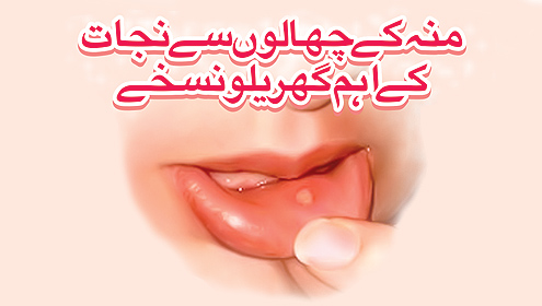 منہ کے چھالوں سے نجات کے اہم گھریلو نسخے