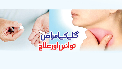 گلے کے امراض … دوائیں اور علاج