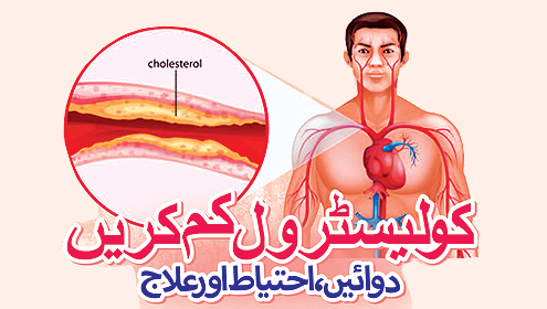 کولیسٹرول کم کریں  دوائیں،احتیاط اور علاج