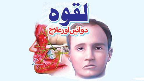 لقوہ دوائیں اور علاج