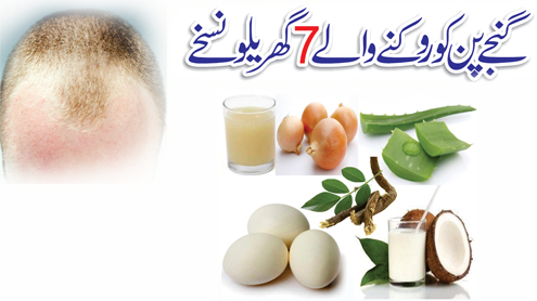 گنجے پن کو روکنے والے 7 گھریلو نسخے