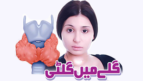 گلے میں گلٹی