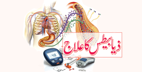ذیابیطس کا علاج