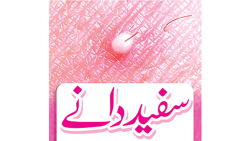 سفید دانے