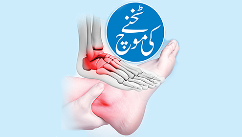 ٹخنے کی موچ 