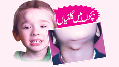 بچوں میں گلٹیاں 