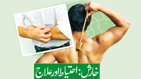 خارش: احتیاط اور علاج