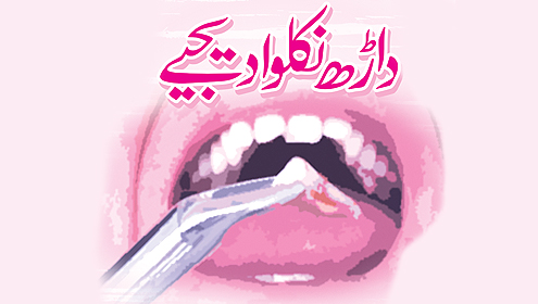 داڑھ نکلوا دیجیے