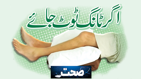 اگر ٹانگ ٹوٹ جائے