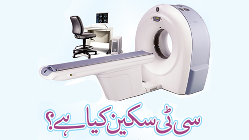 سی ٹی سکین کیا ہے؟
