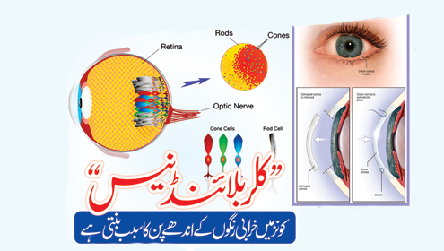 کلر بلائنڈ نیس کونز میں خرابی رنگوں کے اندھے پن کا سبب بنتی ہے