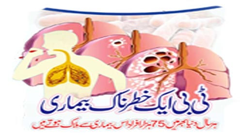 ٹی بی ایک خطرناک بیماری