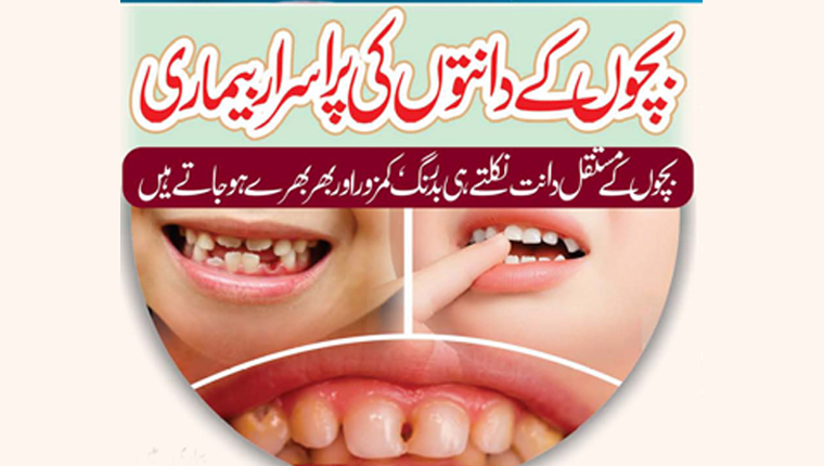 بچوں کے دانتوں کی پراسرار بیماری
